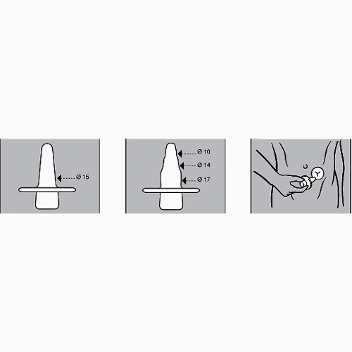 1. Stoma-Dilatator