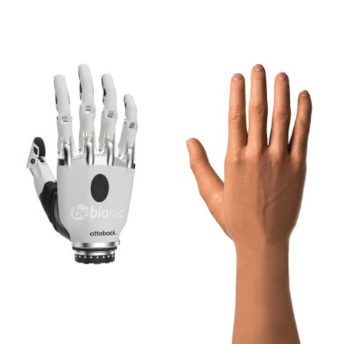 bebionic Hand